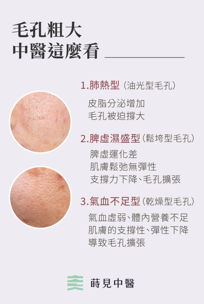中醫治療毛孔粗大