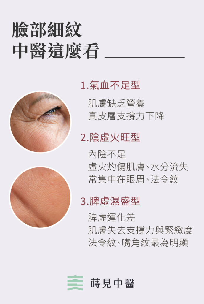中醫治療眼周細紋