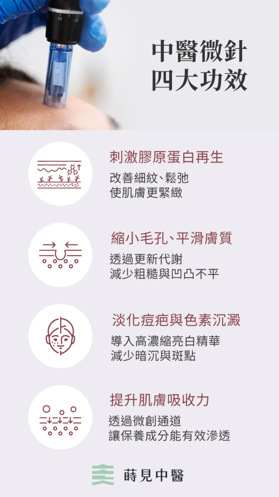 中醫微針4大功效