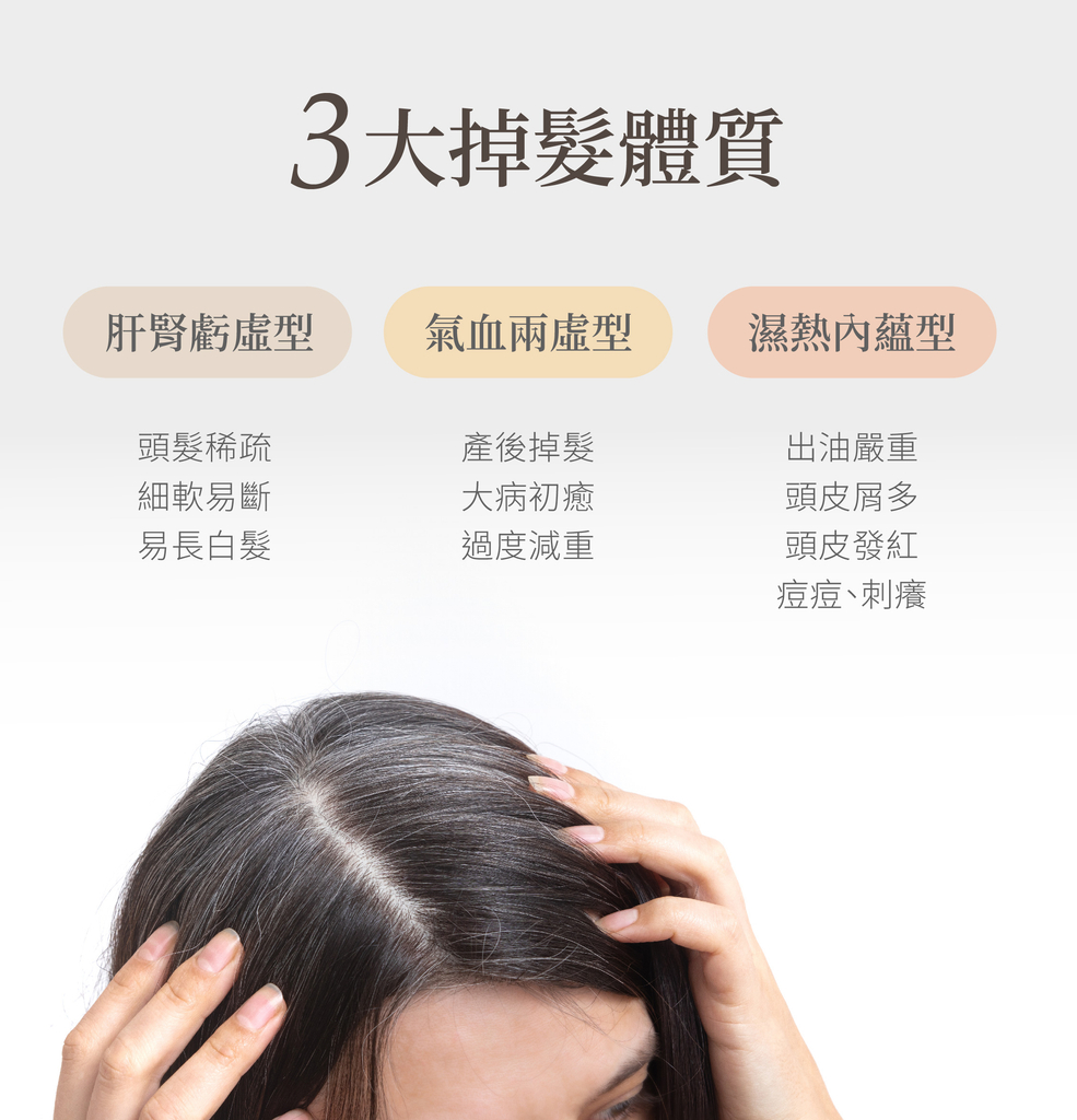 中醫3大掉髮體質